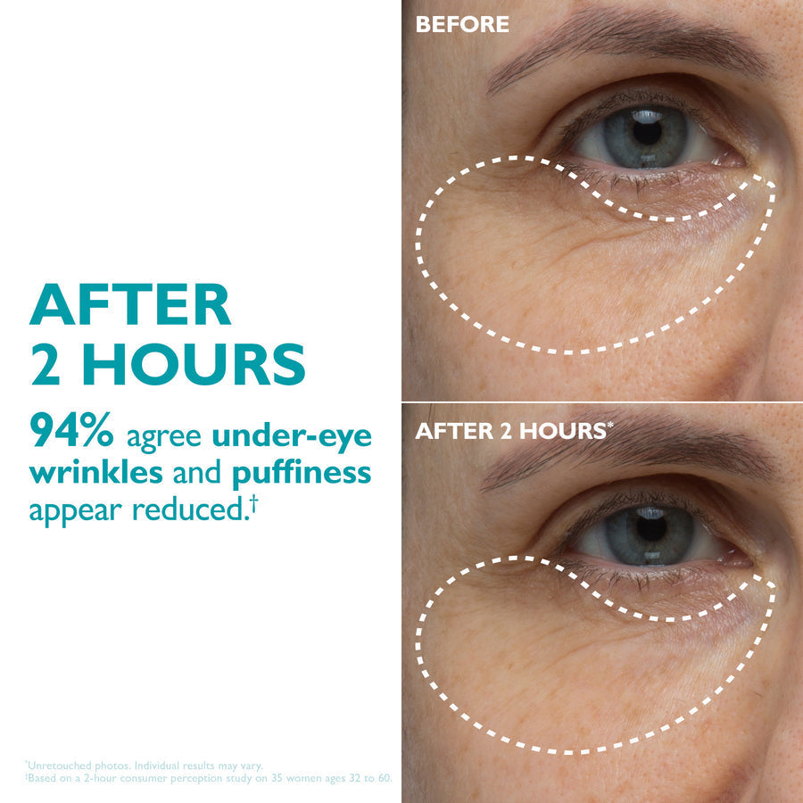 Peptide Skinjection® Peptide-Infused Face & Eye Tape