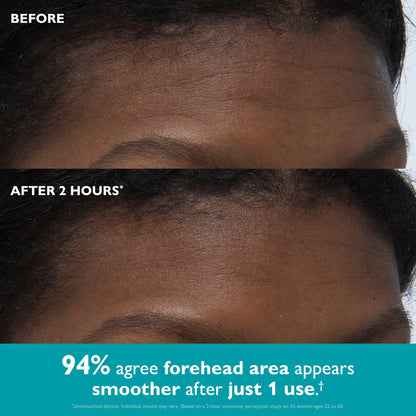 Peptide Skinjection® Peptide-Infused Face & Eye Tape