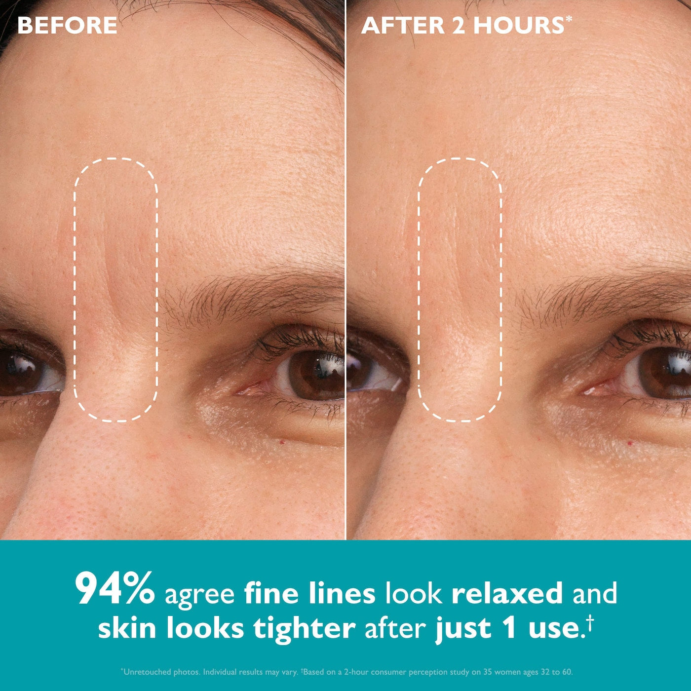 Peptide Skinjection® Peptide-Infused Face & Eye Tape