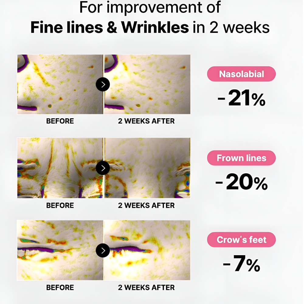 Milane™ Korean Eye Patches