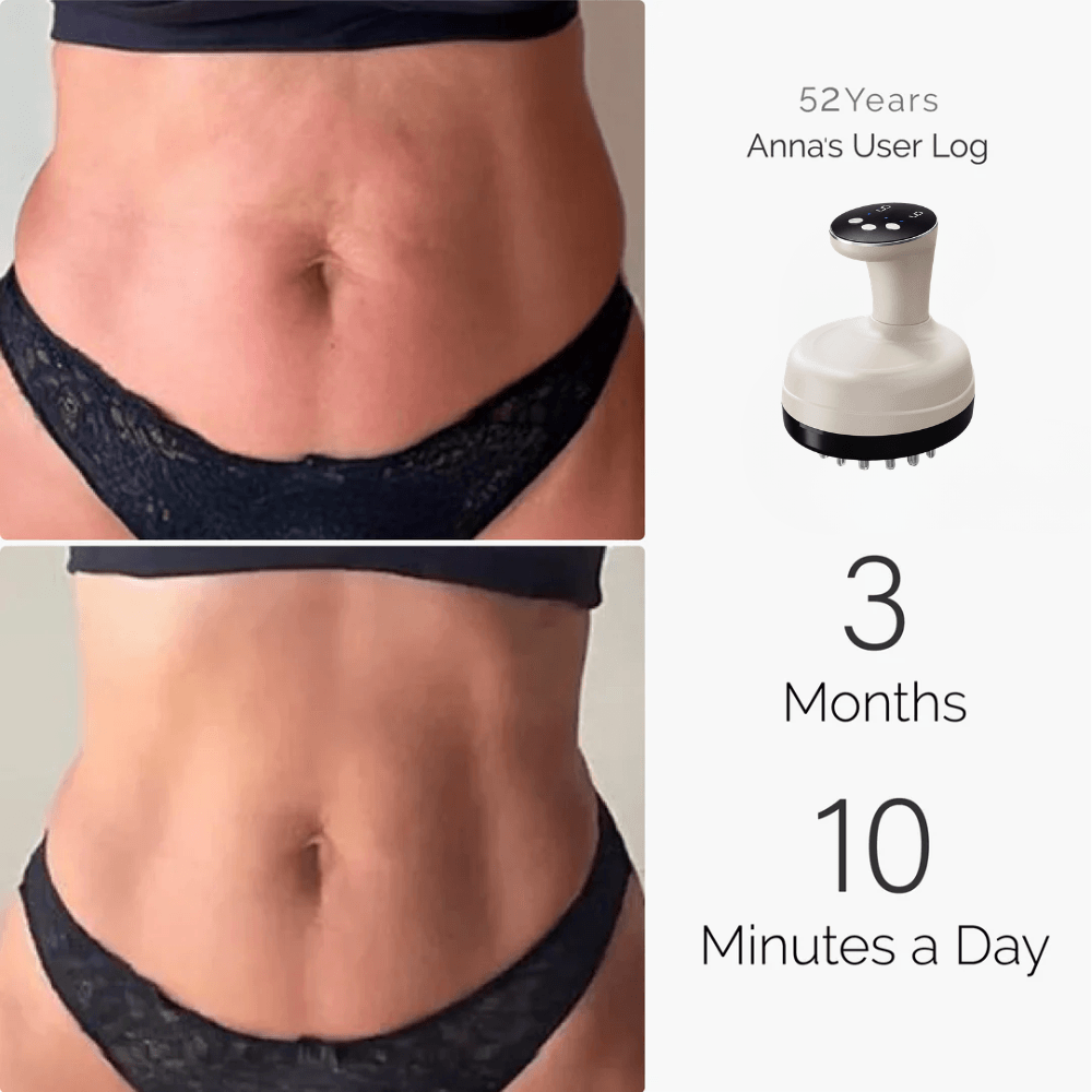 Milane™ – EMS Red Light Lymphatic Drainage Sculpting System