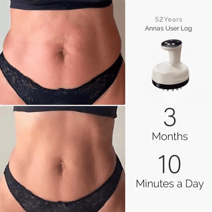 Milane™ – EMS Red Light Lymphatic Drainage Sculpting System