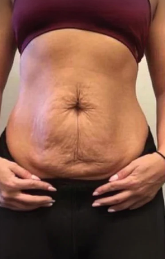 Before - Julie