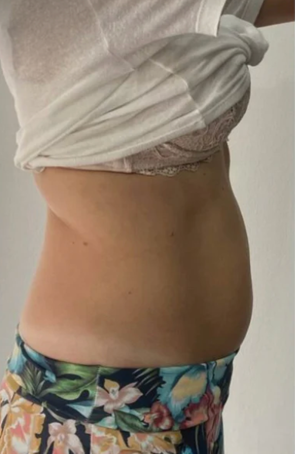 Before - Sara
