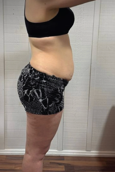 Before - Lisa