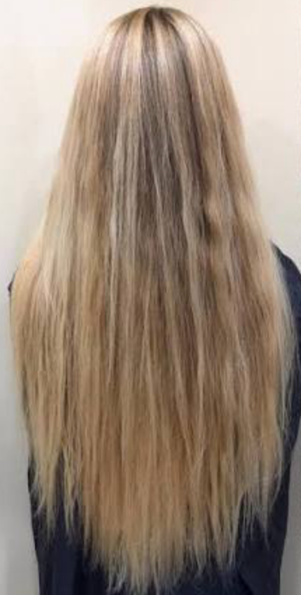 Before - Anna