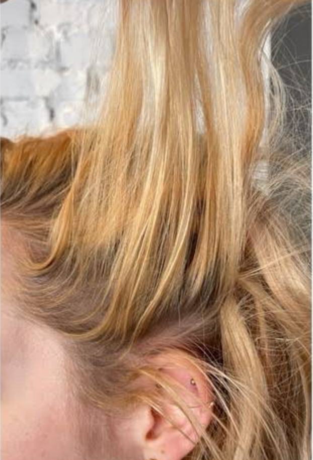 Before - Lisa