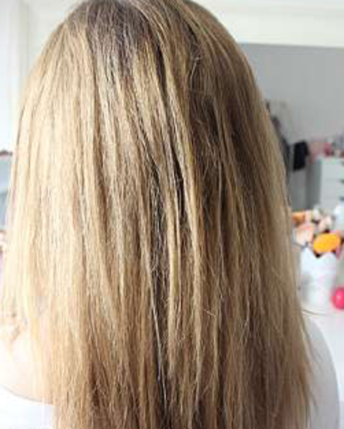 Before - Shanna